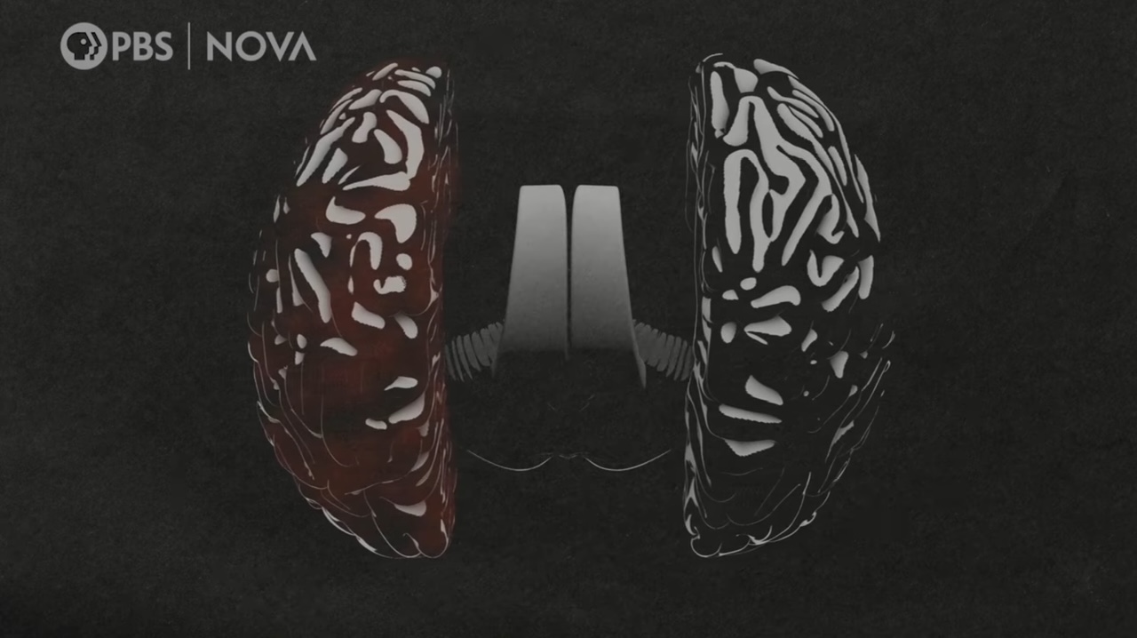 NOVA Split Brain